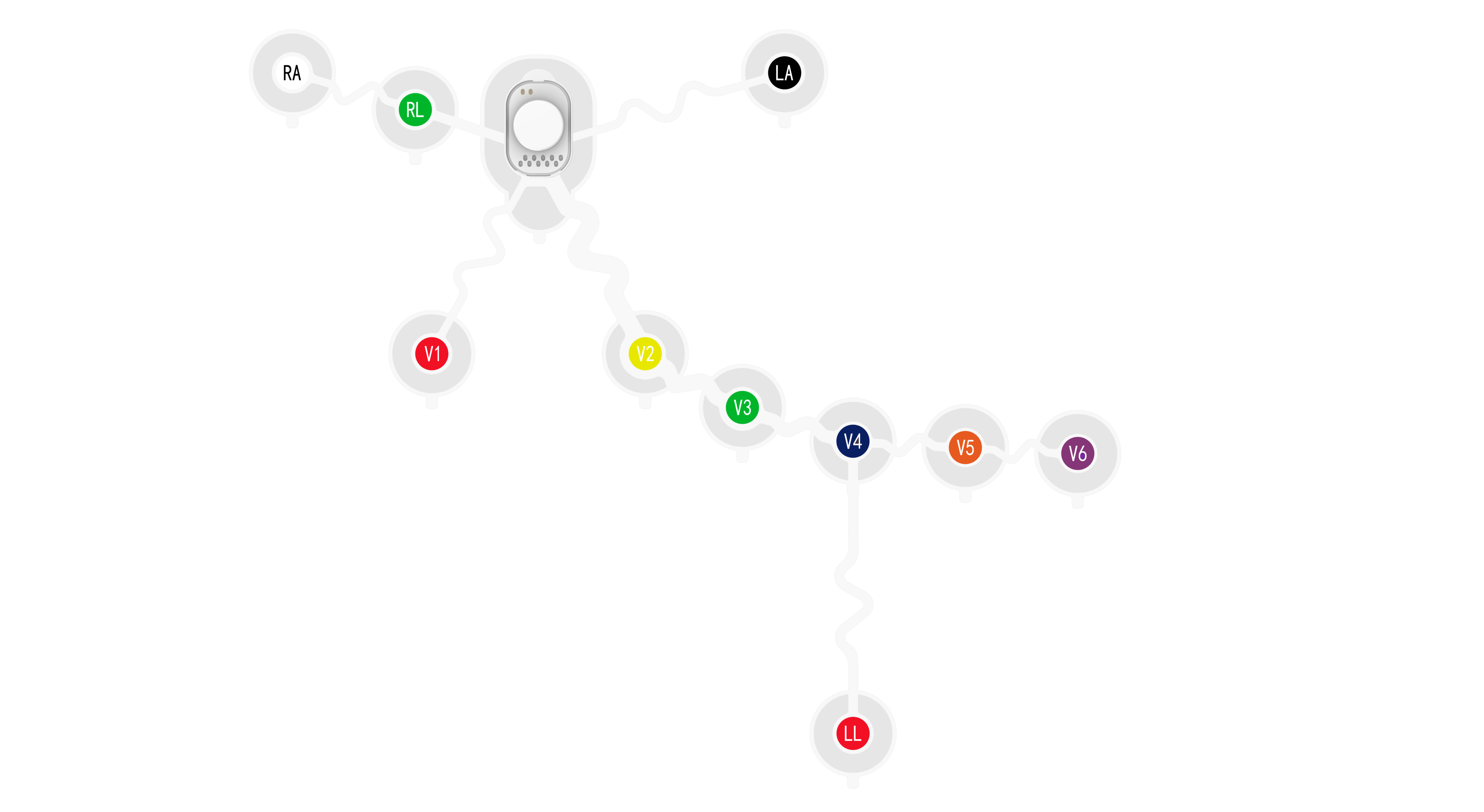 12-Lead Wearable ECG sensor