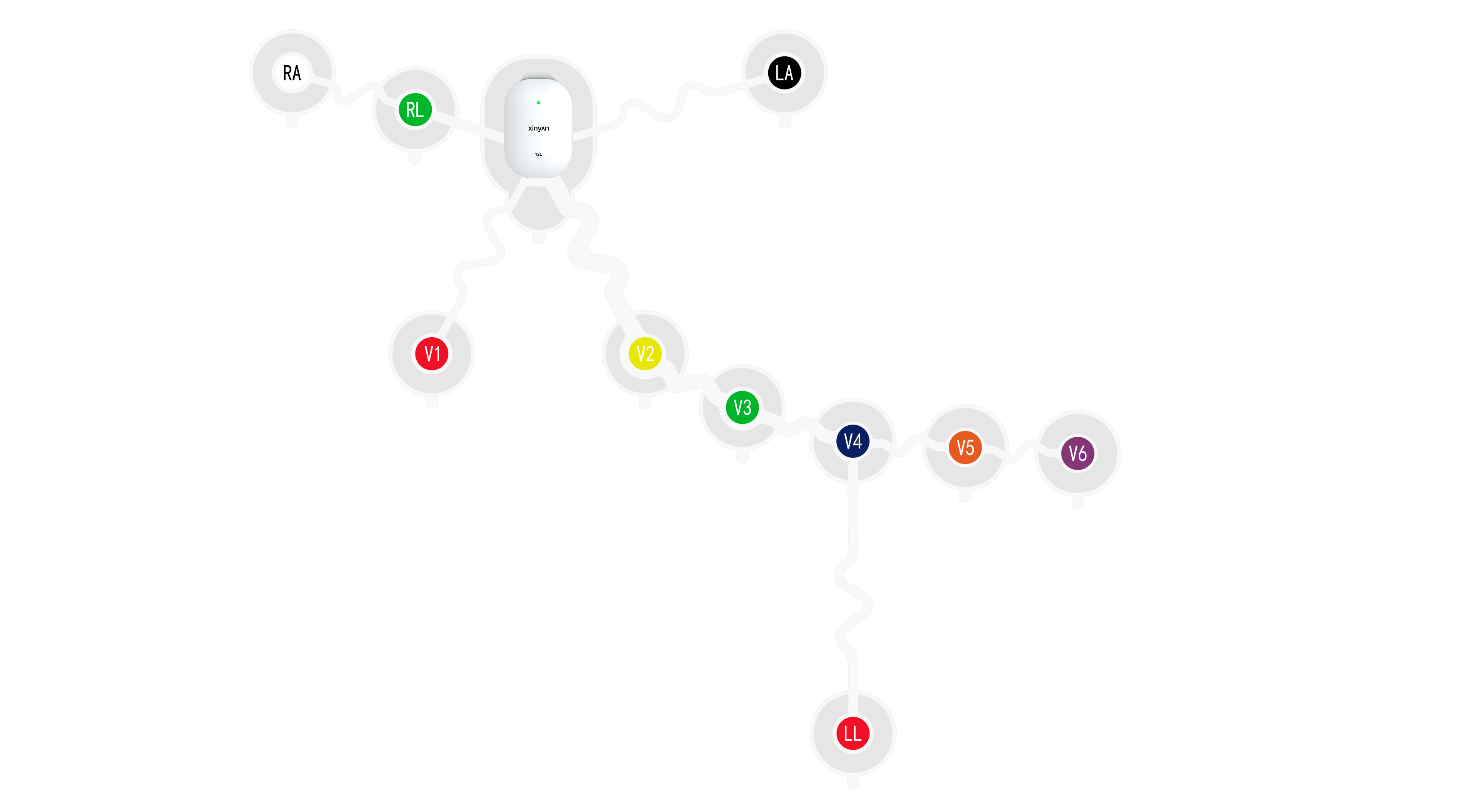 12-Lead Wearable ECG Monitor